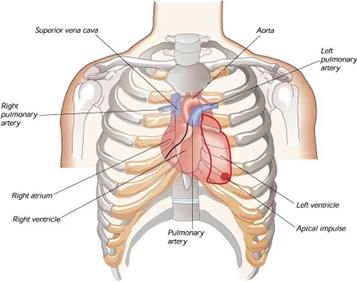 heart-attack2