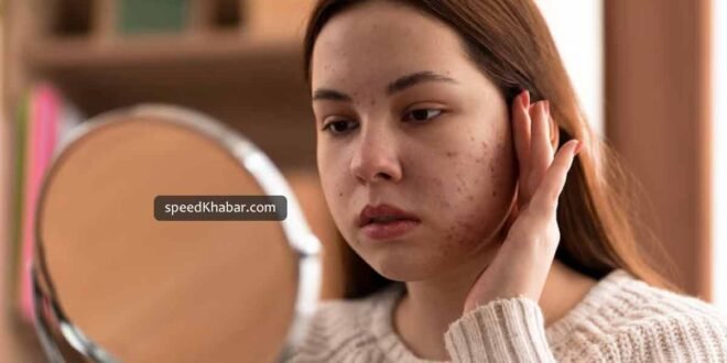 Pigmentation causes