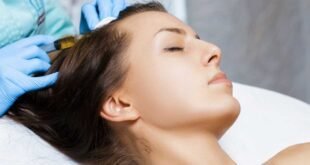 cure alopecia